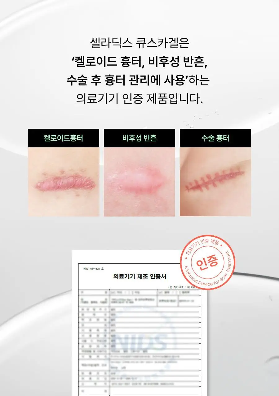 [흉터관리 의료기기] 셀라딕스 큐스카겔 10g 상세페이지 11